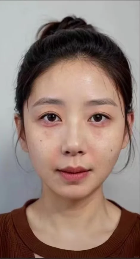 30+突然get少女肌