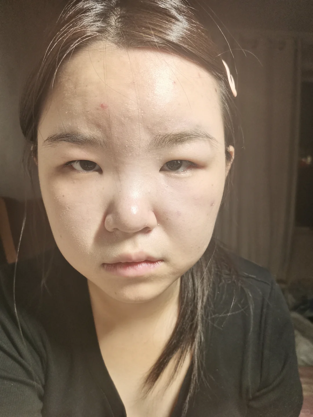 17岁脸垮成这样还有救吗