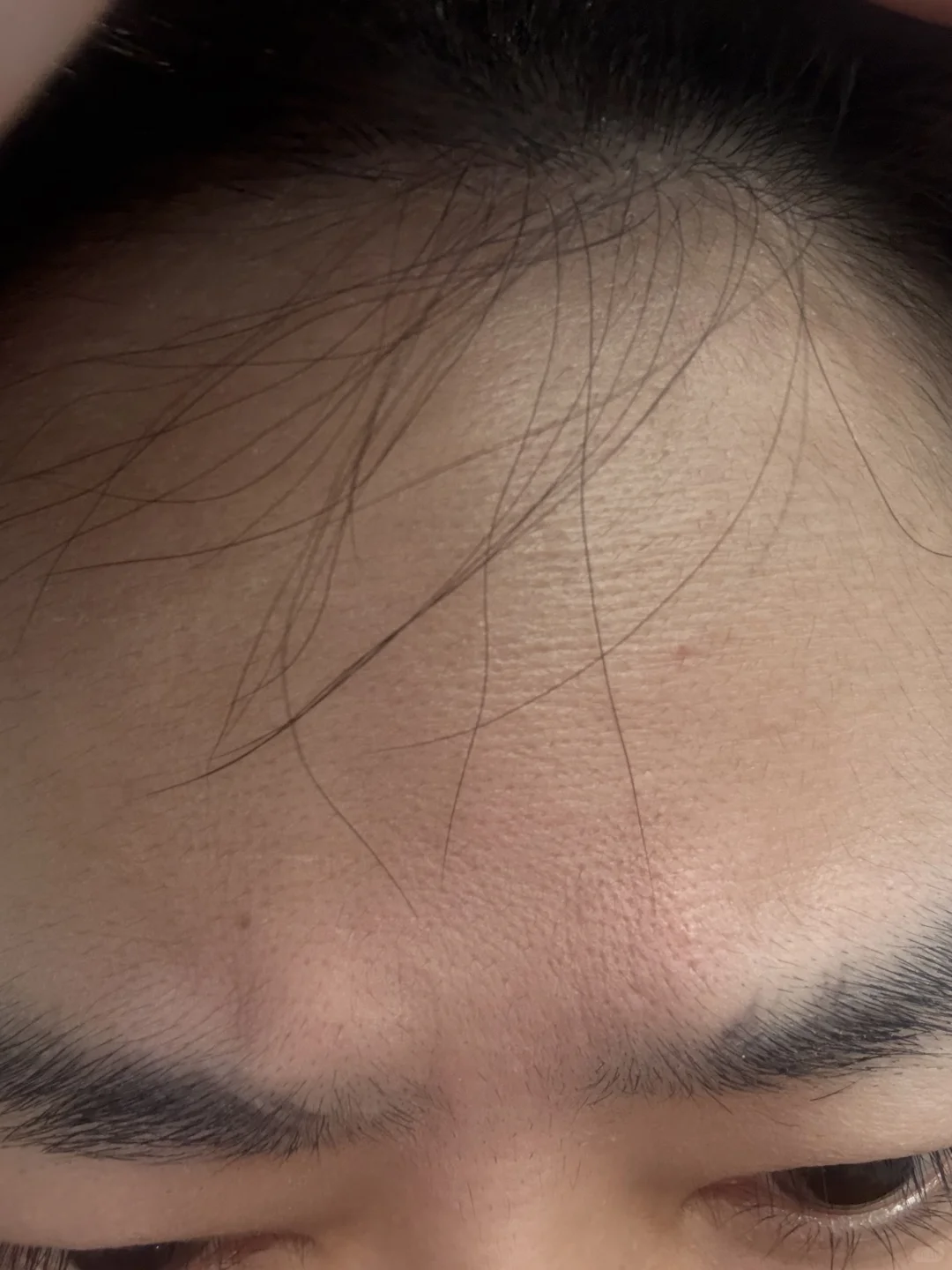 43岁的脸怎么保养？