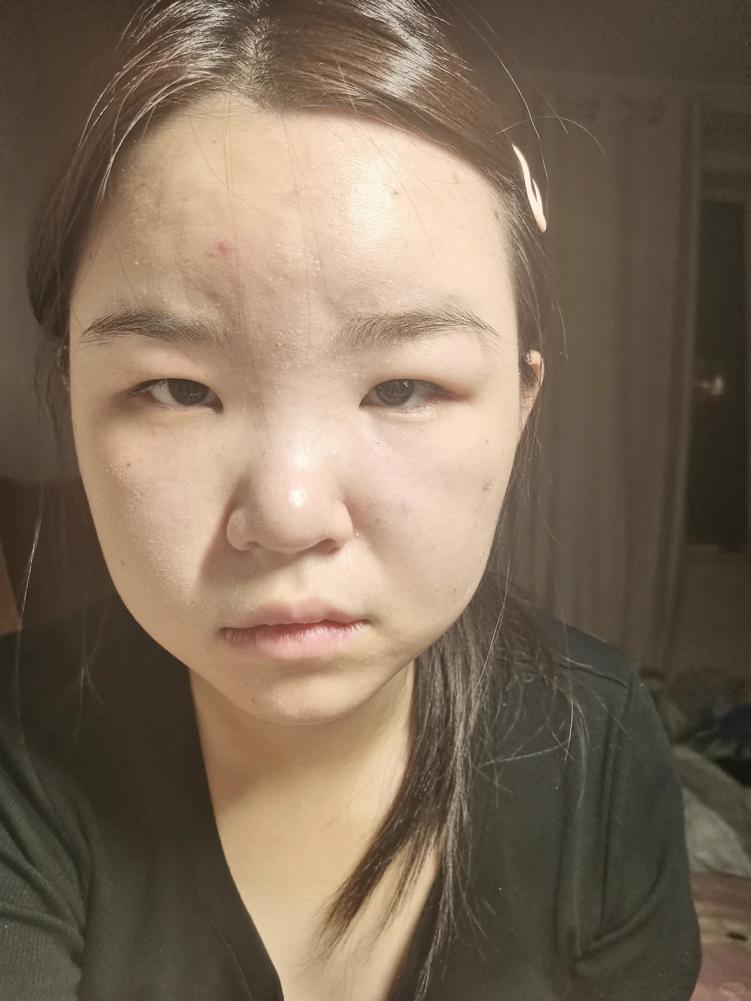 17岁脸垮成这样还有救吗