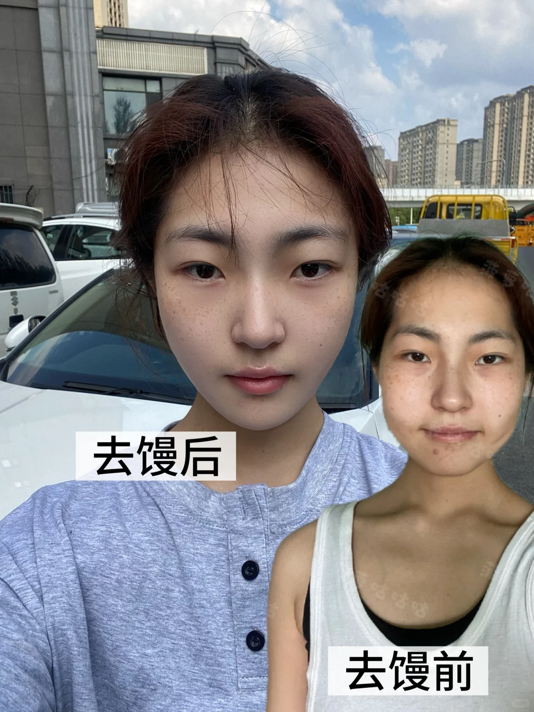 去M后脸蛋饱满，脸小了10斤？