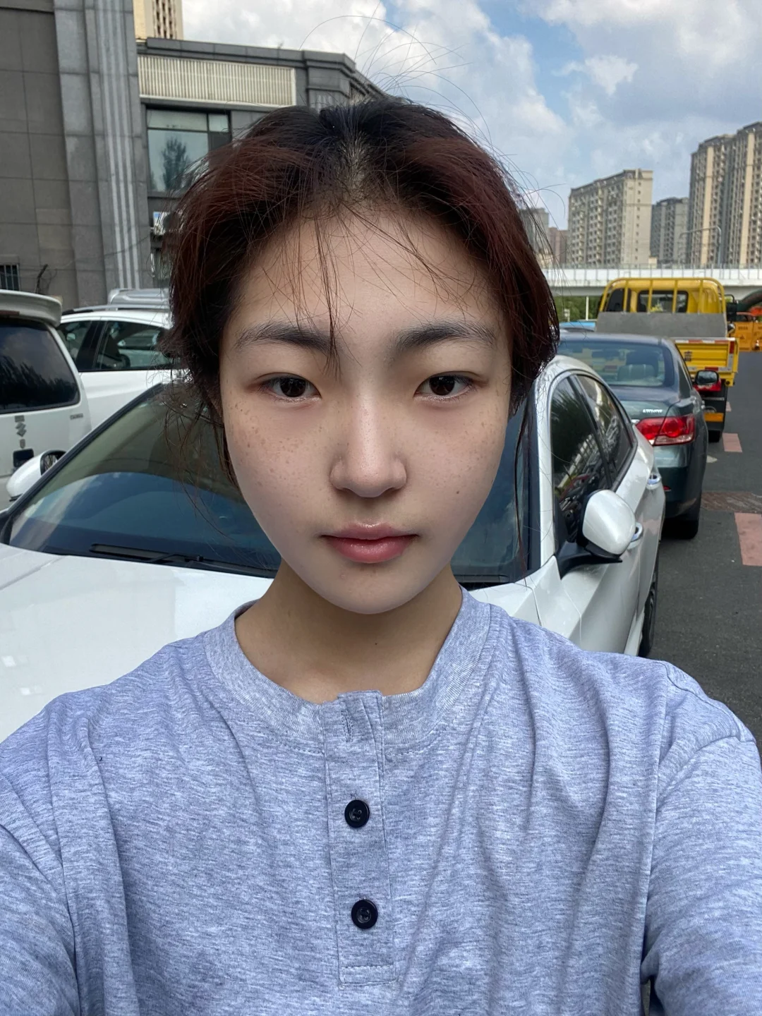 去M后脸蛋饱满，脸小了10斤？