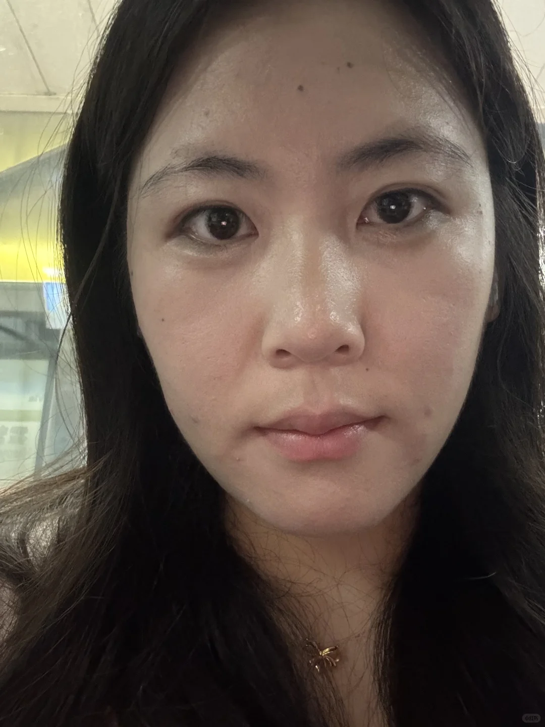 为什么我脸上的纹路这么明显