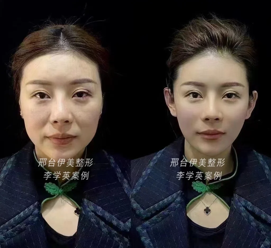 美的惊艳