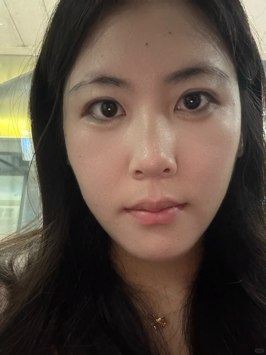 为什么我脸上的纹路这么明显