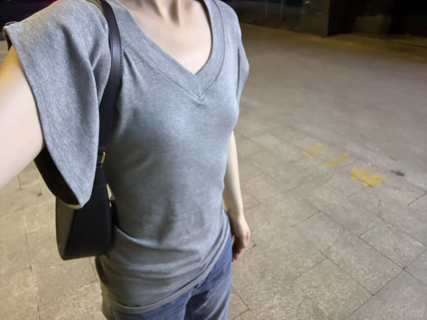 28岁平胸还有救吗？