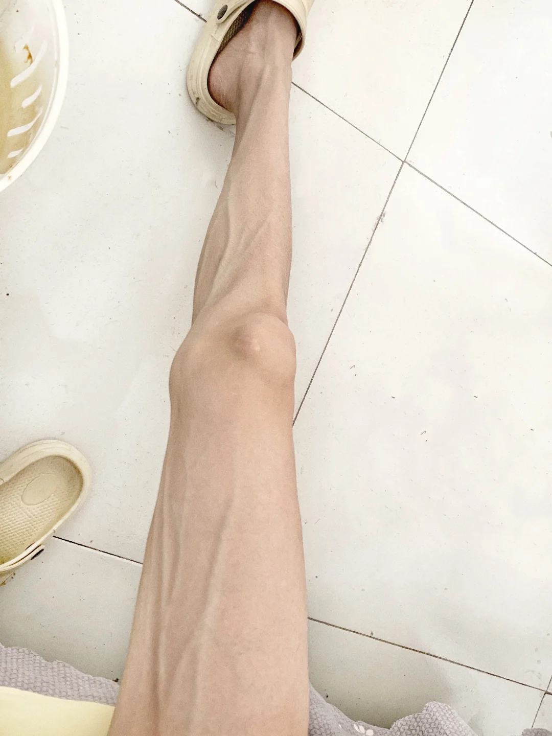 162 36kg｜ed，迷恋瘦是少女时代的淤青