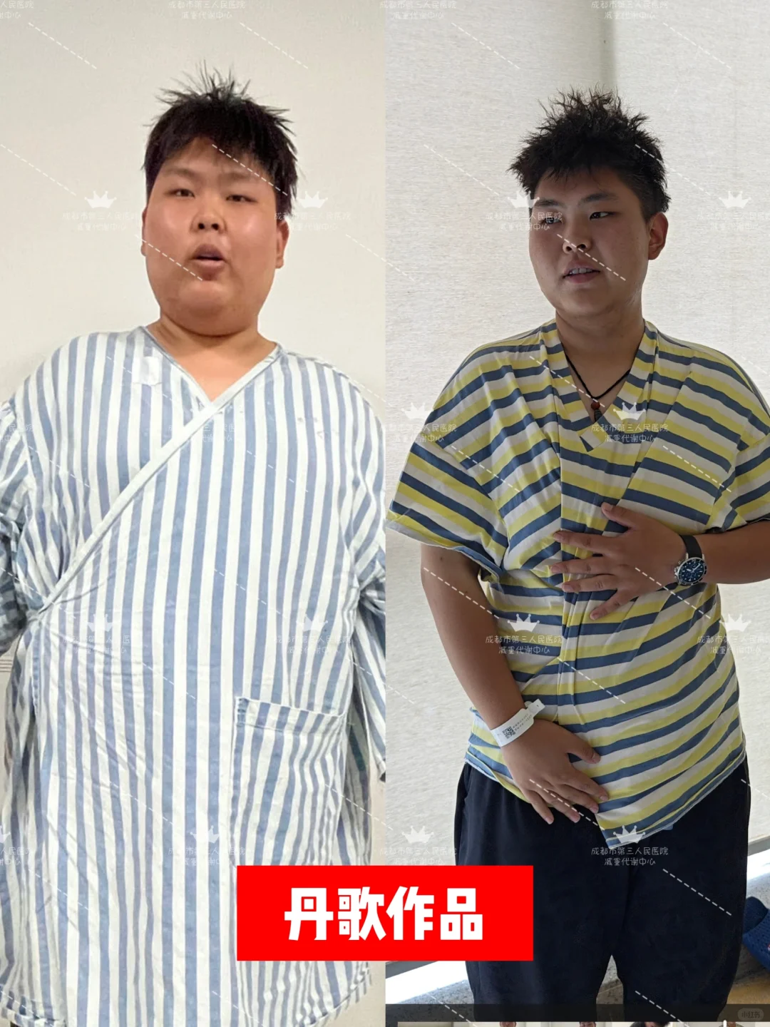 🏋️‍♀️怎么正确选择减重方式？