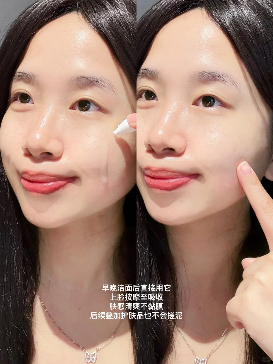 变美后烂脸？15天换皮实录