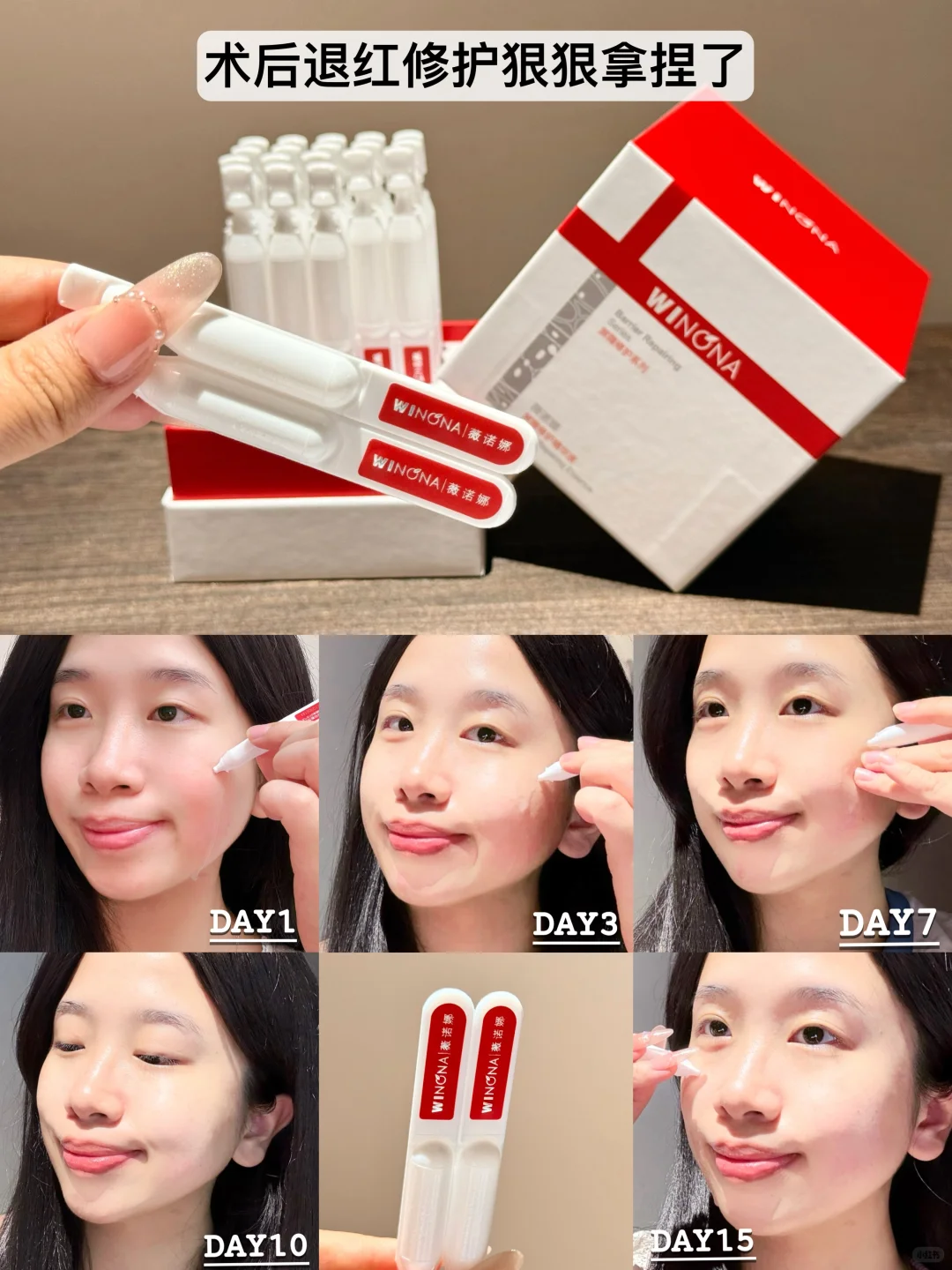 变美后烂脸？15天换皮实录