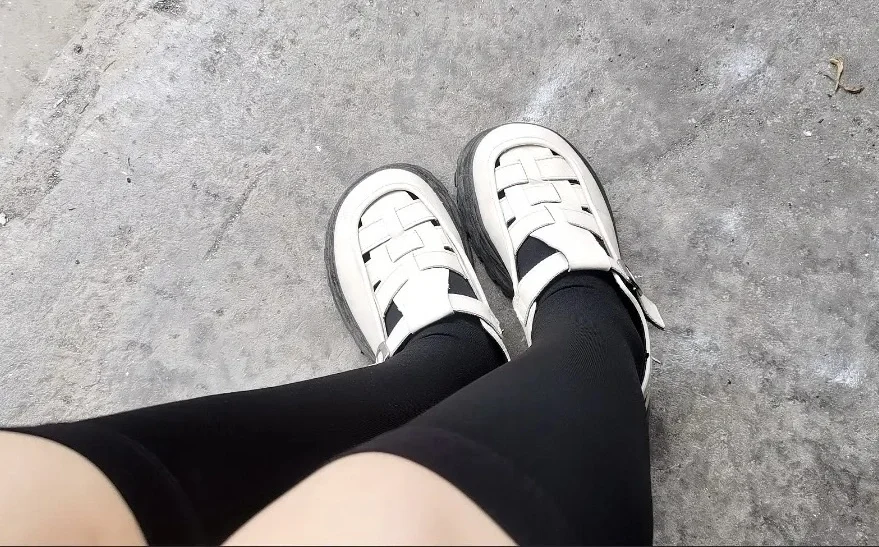 静脉曲张又怎么了，我照样穿！！！