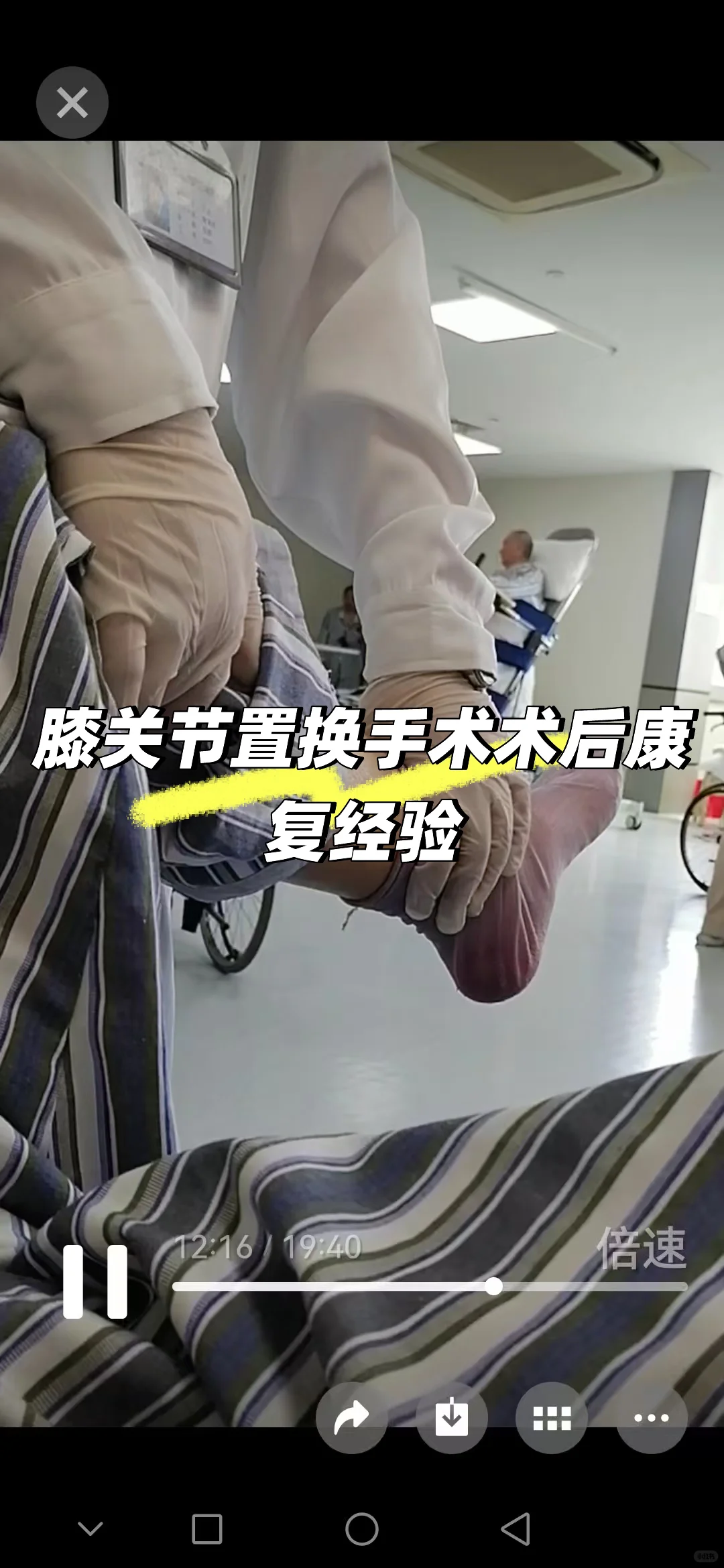 膝关节置换术后康复纯干货！！！经验分享