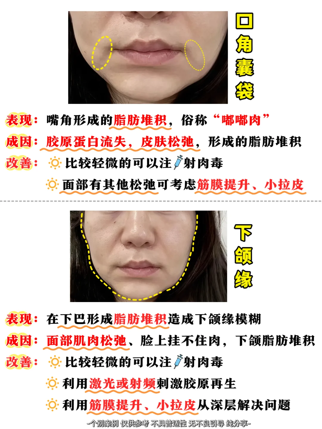 医美大白说真话|衰老跨脸表现自测❗
