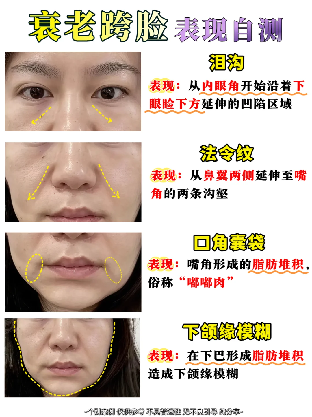 医美大白说真话|衰老跨脸表现自测❗