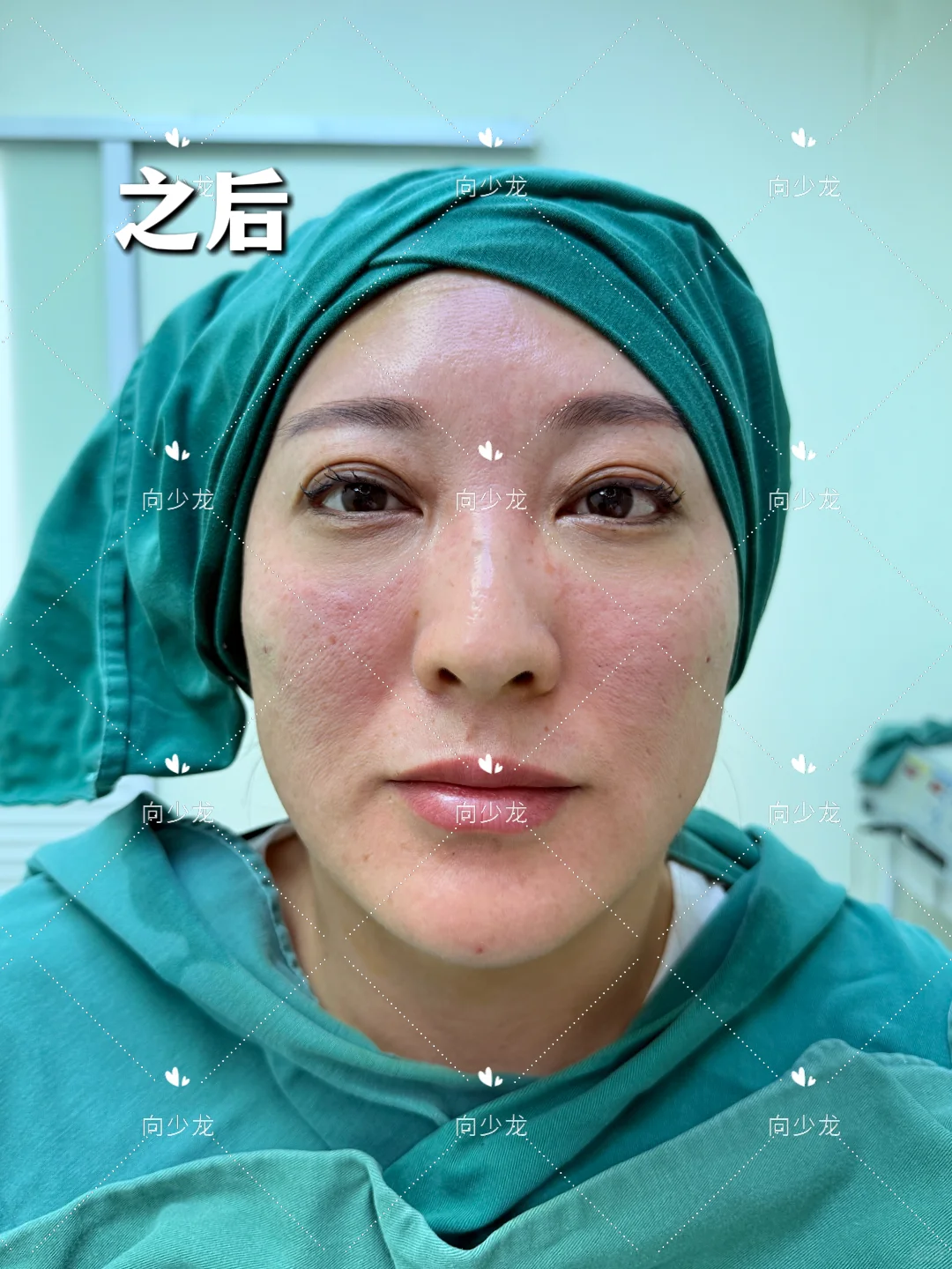 宋祖儿其实长相是帅气+幼态的