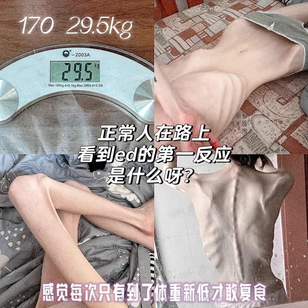 ED 170/29.5kg 其实已经复食快两周啦