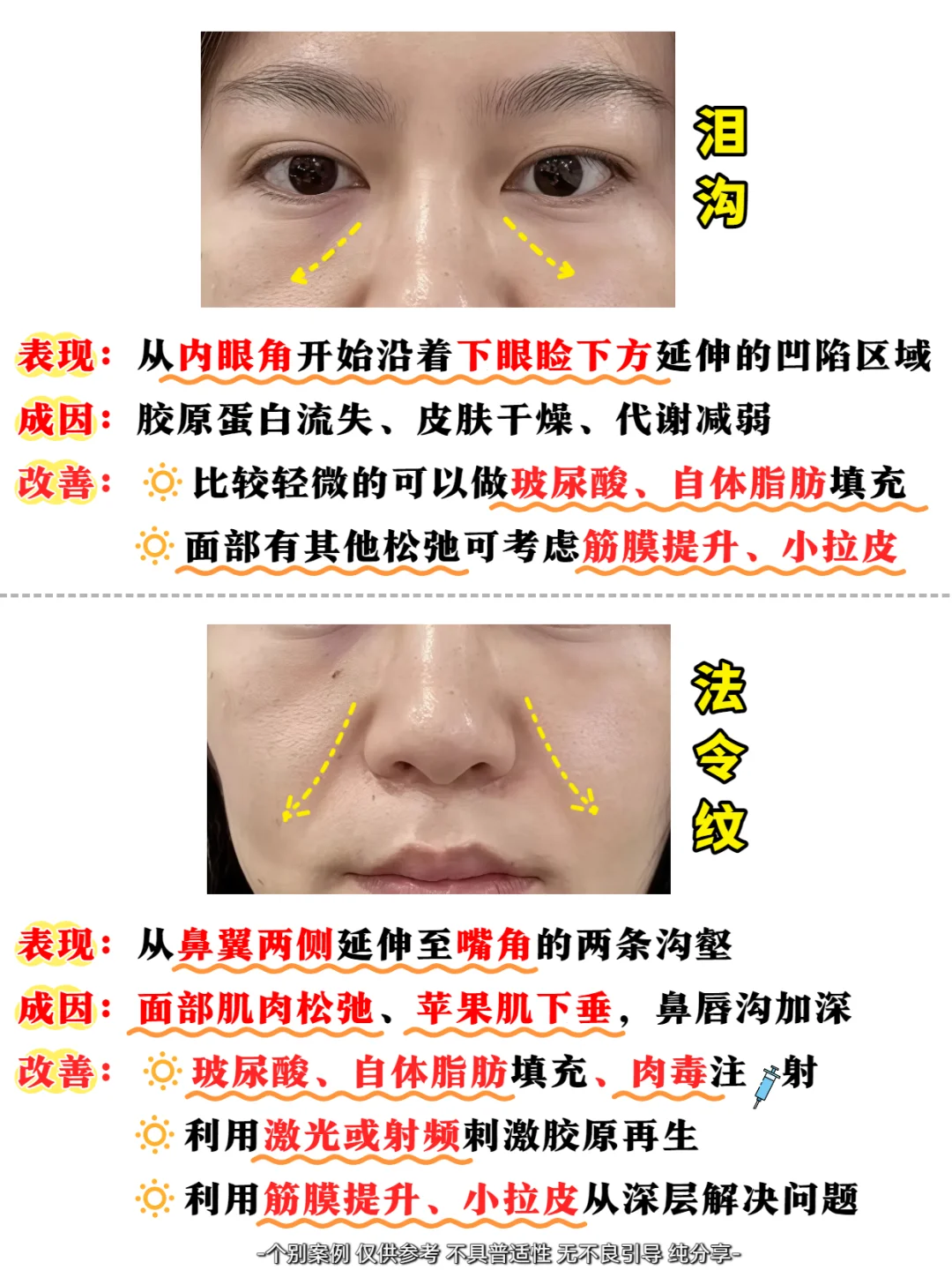 医美大白说真话|衰老跨脸表现自测❗