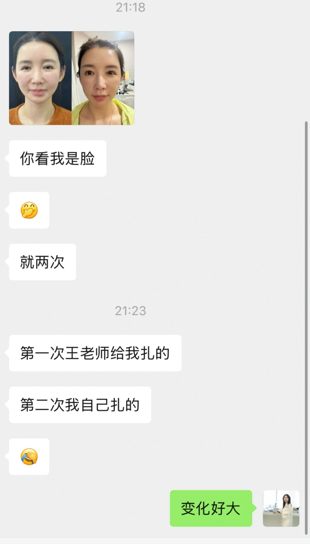 反馈，变美了