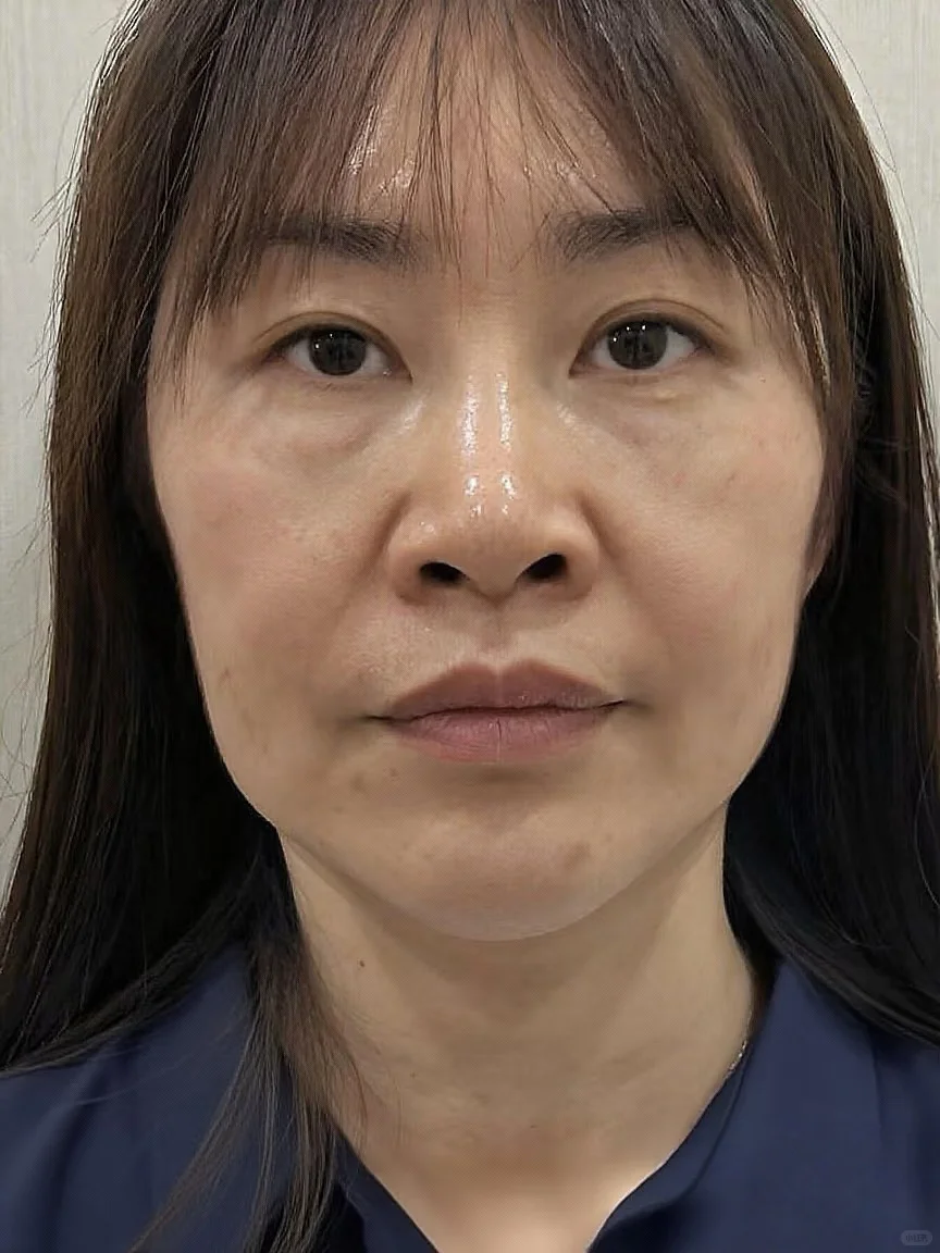 調了，效果明显吗？