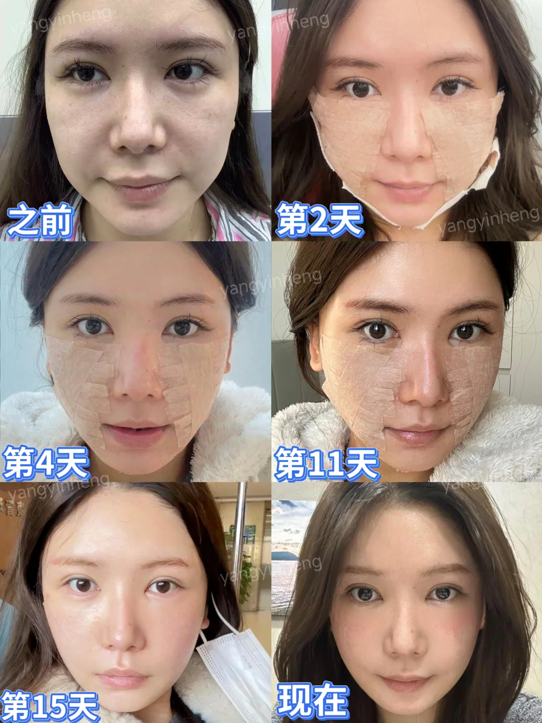 从馒化垮脸→紧致提升❗这才是有效变美思路