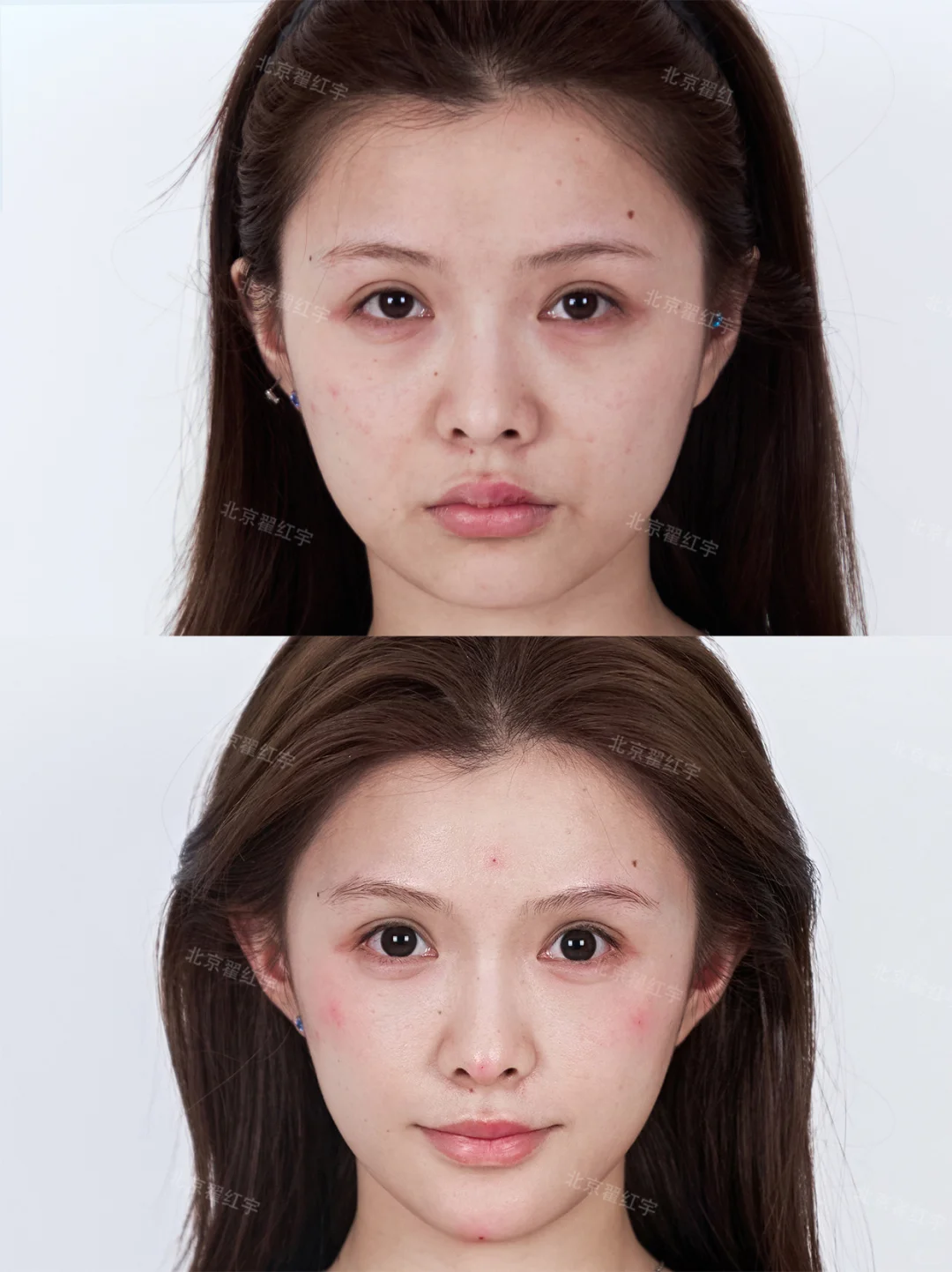 阔面型方圆脸有效变美｜你还是你 但更精致了