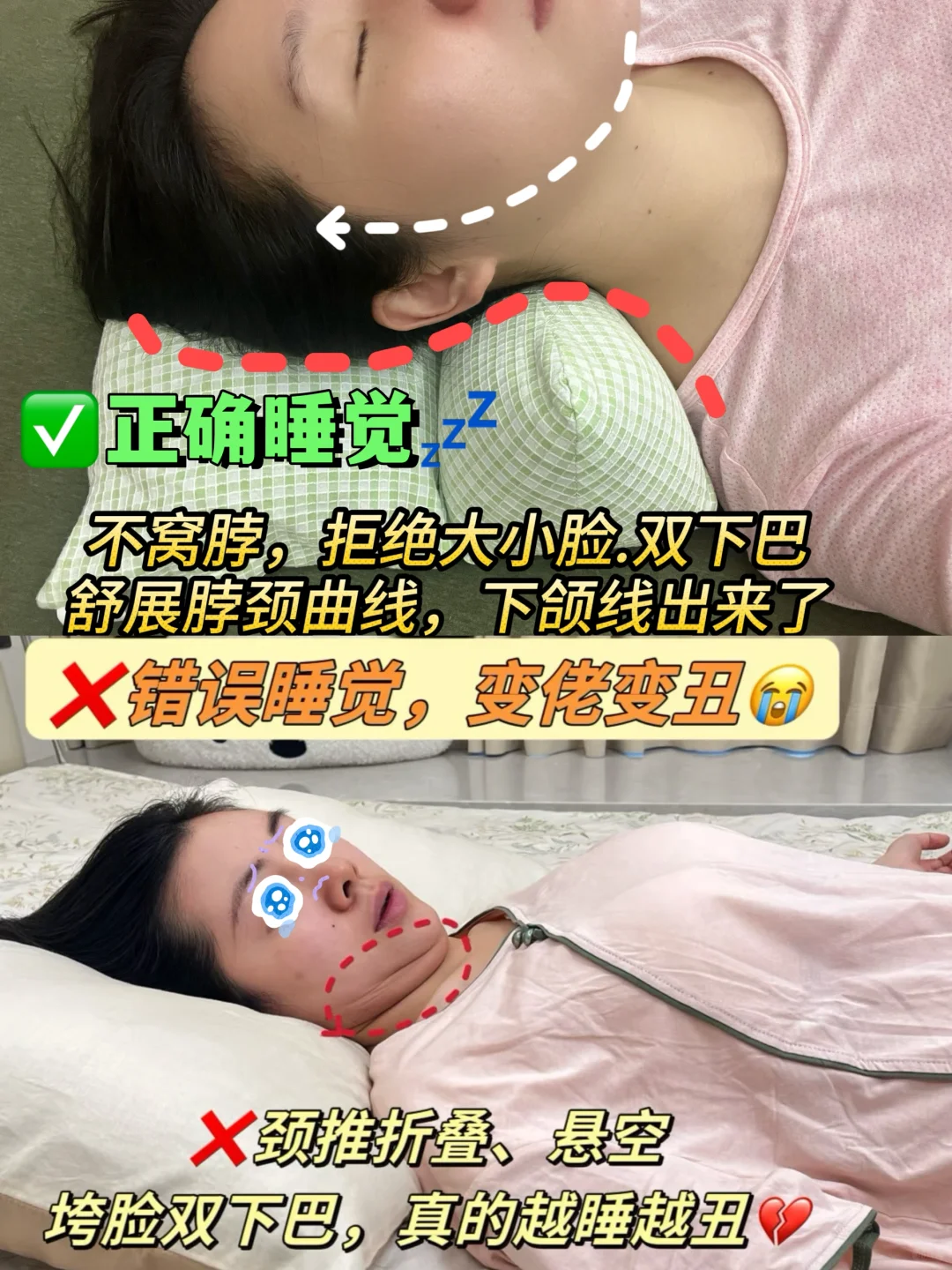 侧睡党看过来❗️ 别让睡觉悄悄“挤垮”脸