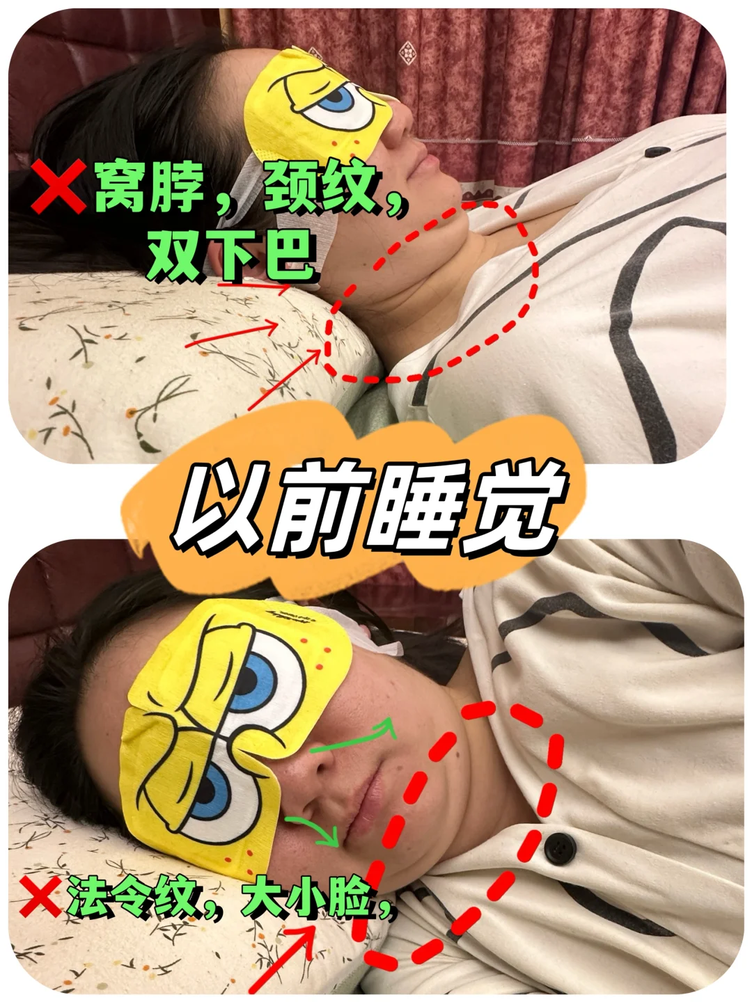 侧睡党看过来❗️ 别让睡觉悄悄“挤垮”脸