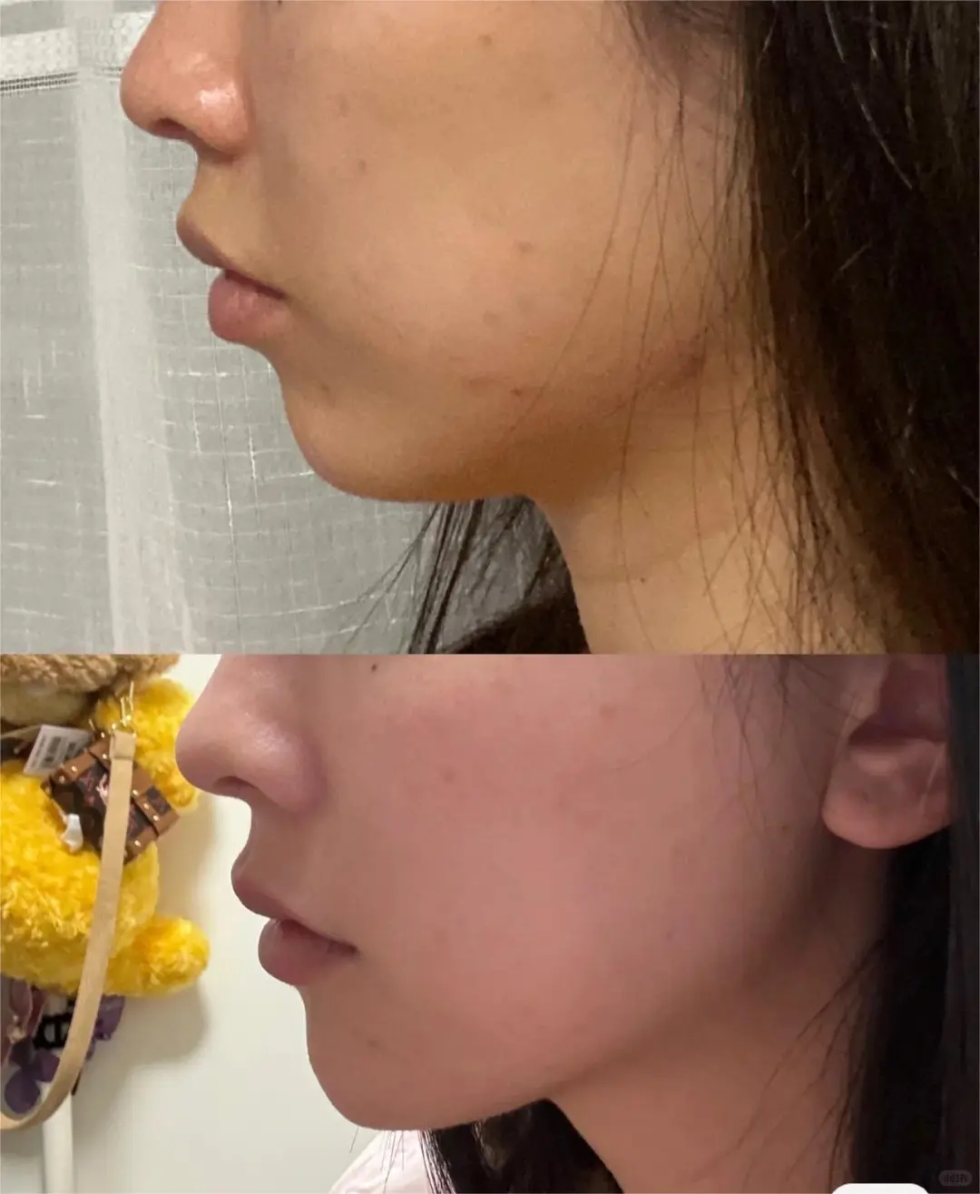 天呐！这款明星推荐的瘦脸神器真的逆天~~~