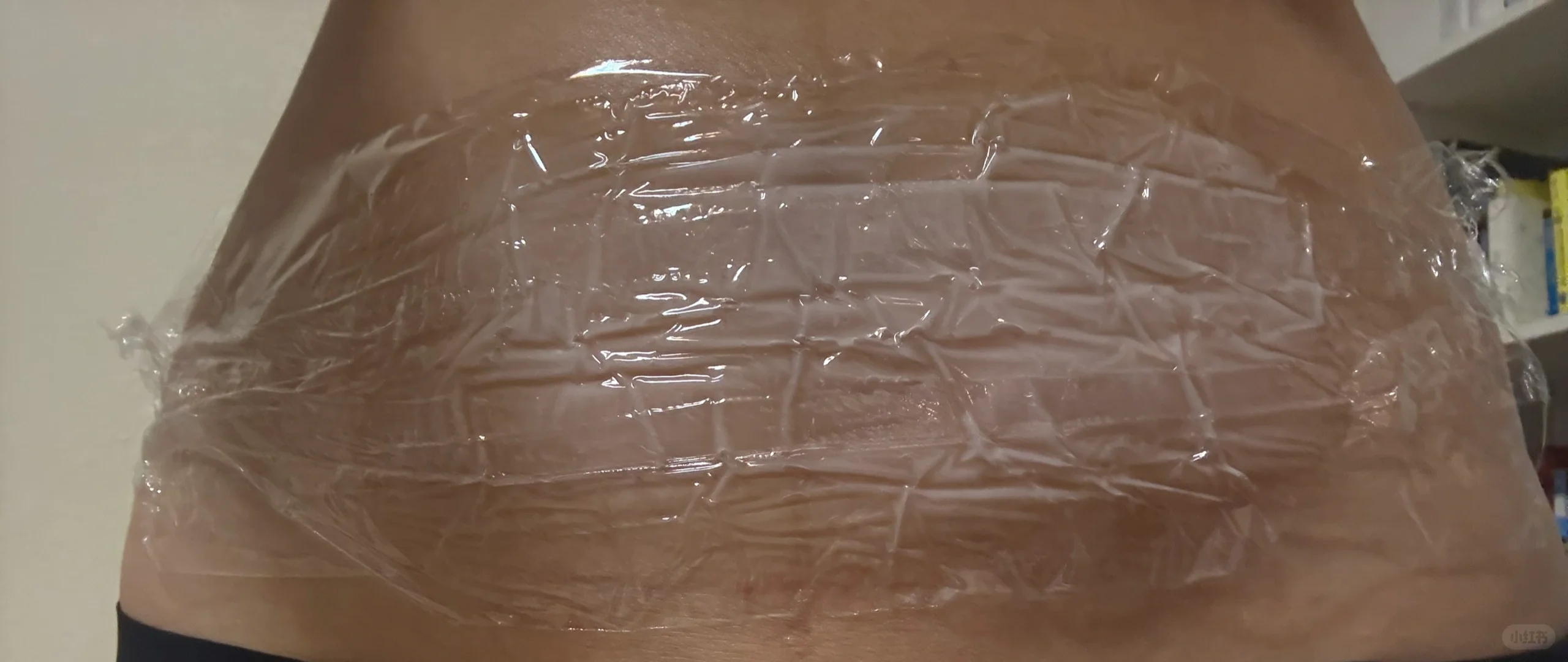 MSDK皮贴骨第6次