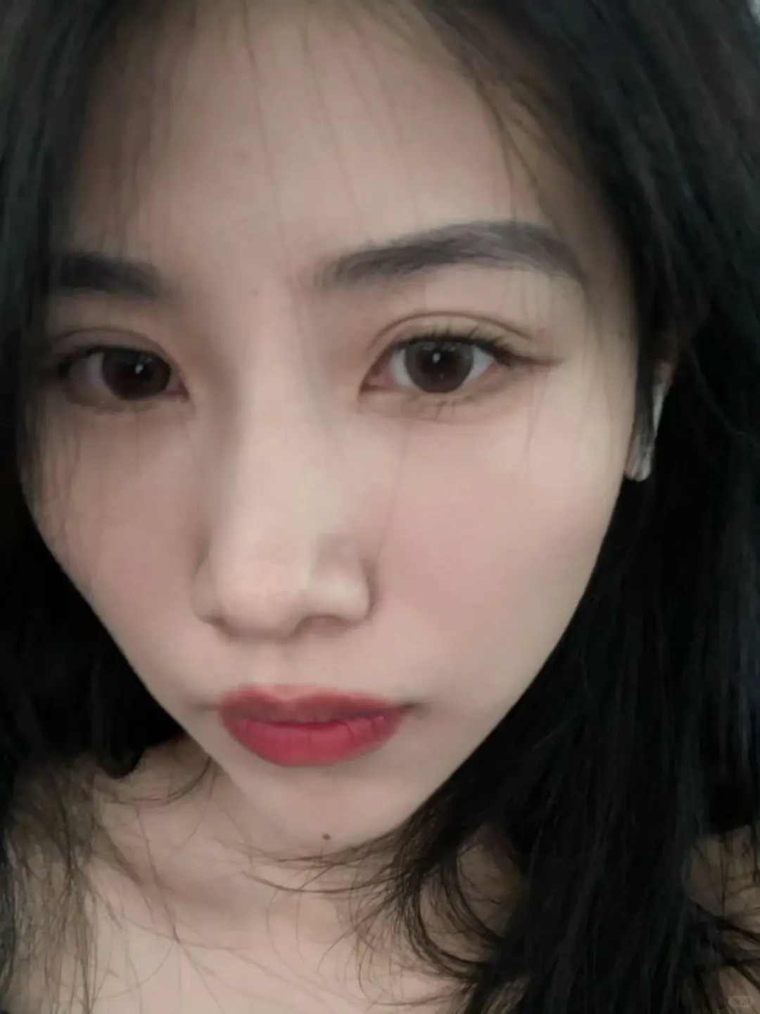 大小脸打完瘦脸针后