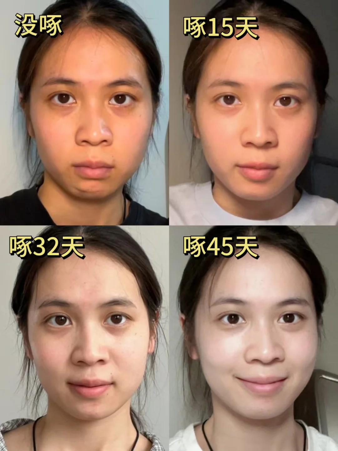 朱雀三啄45天，才明白对大黄脸的含金量