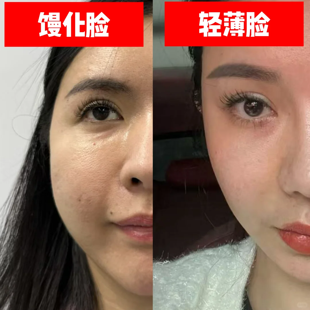 馒化脸vs轻薄脸，解脱就是这么简答