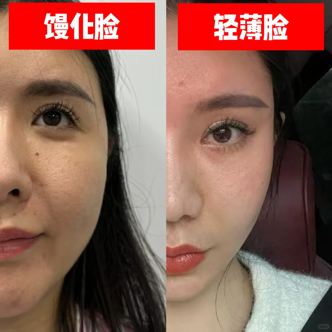馒化脸vs轻薄脸，解脱就是这么简答
