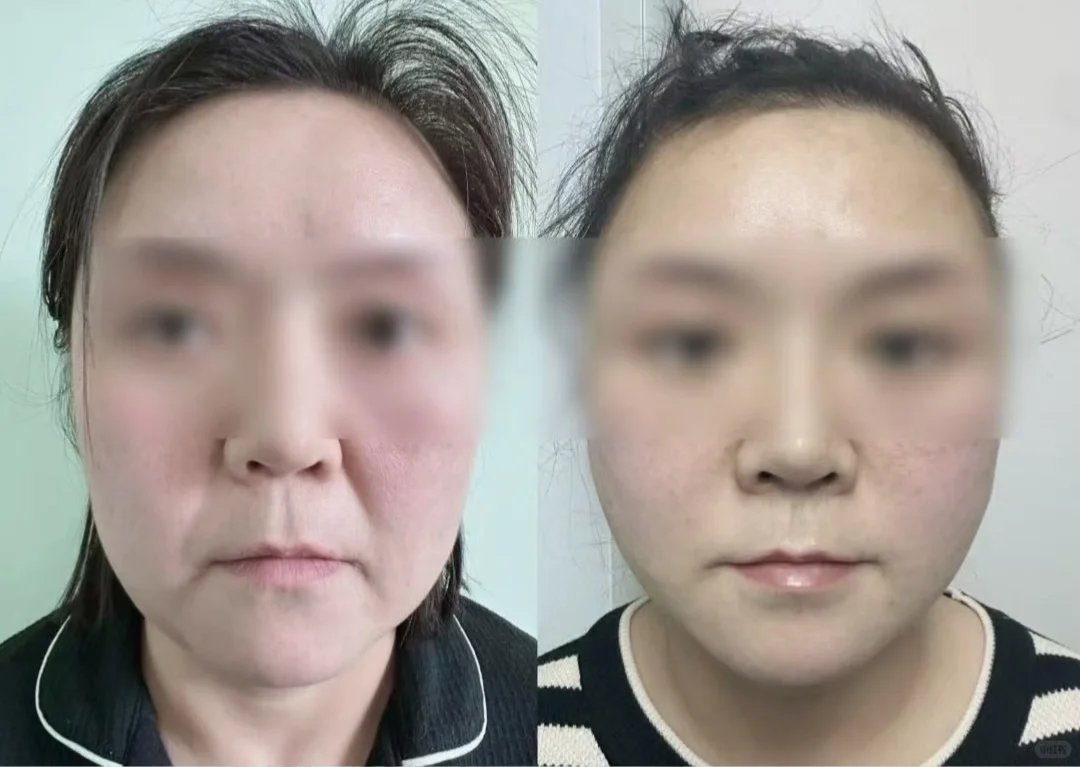 精致的医美脸，不是梦～