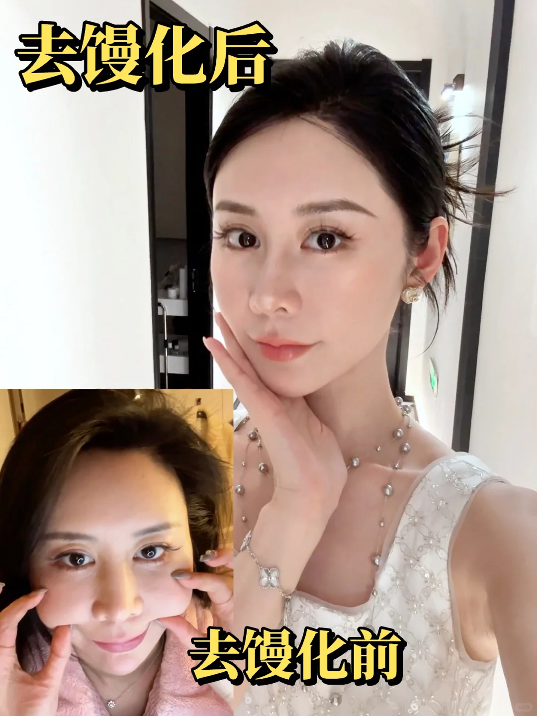 从28岁馒化脸到35岁皮贴骨❗️逆袭了姐妹👭