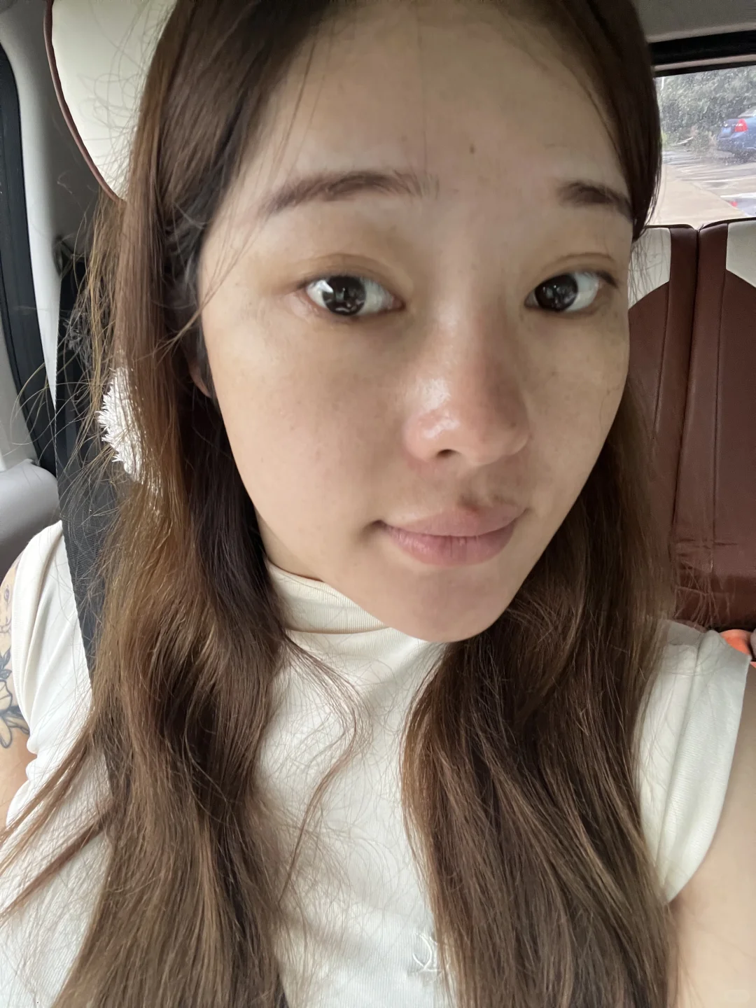 怎么与这一脸的斑和解
