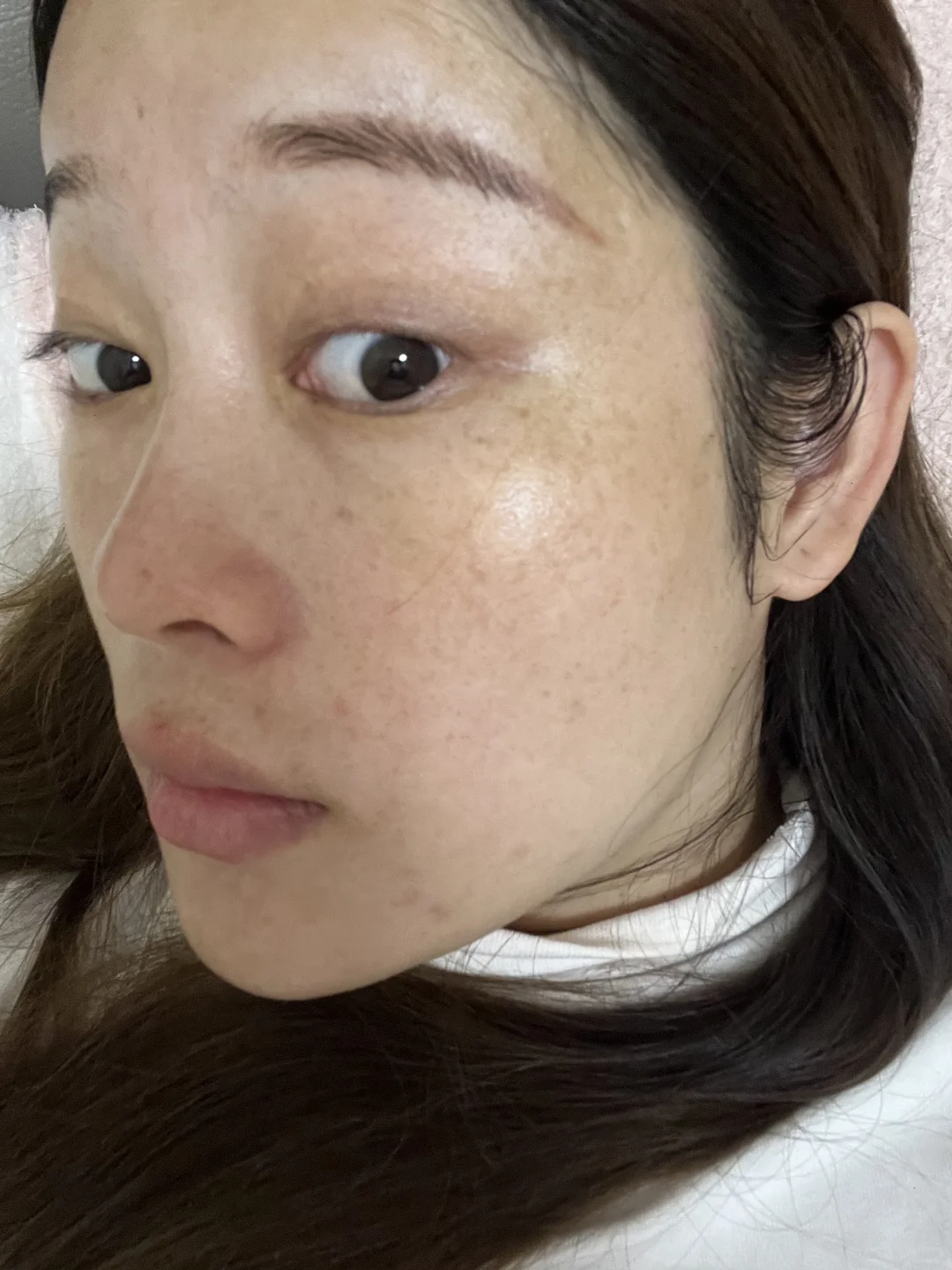 怎么与这一脸的斑和解