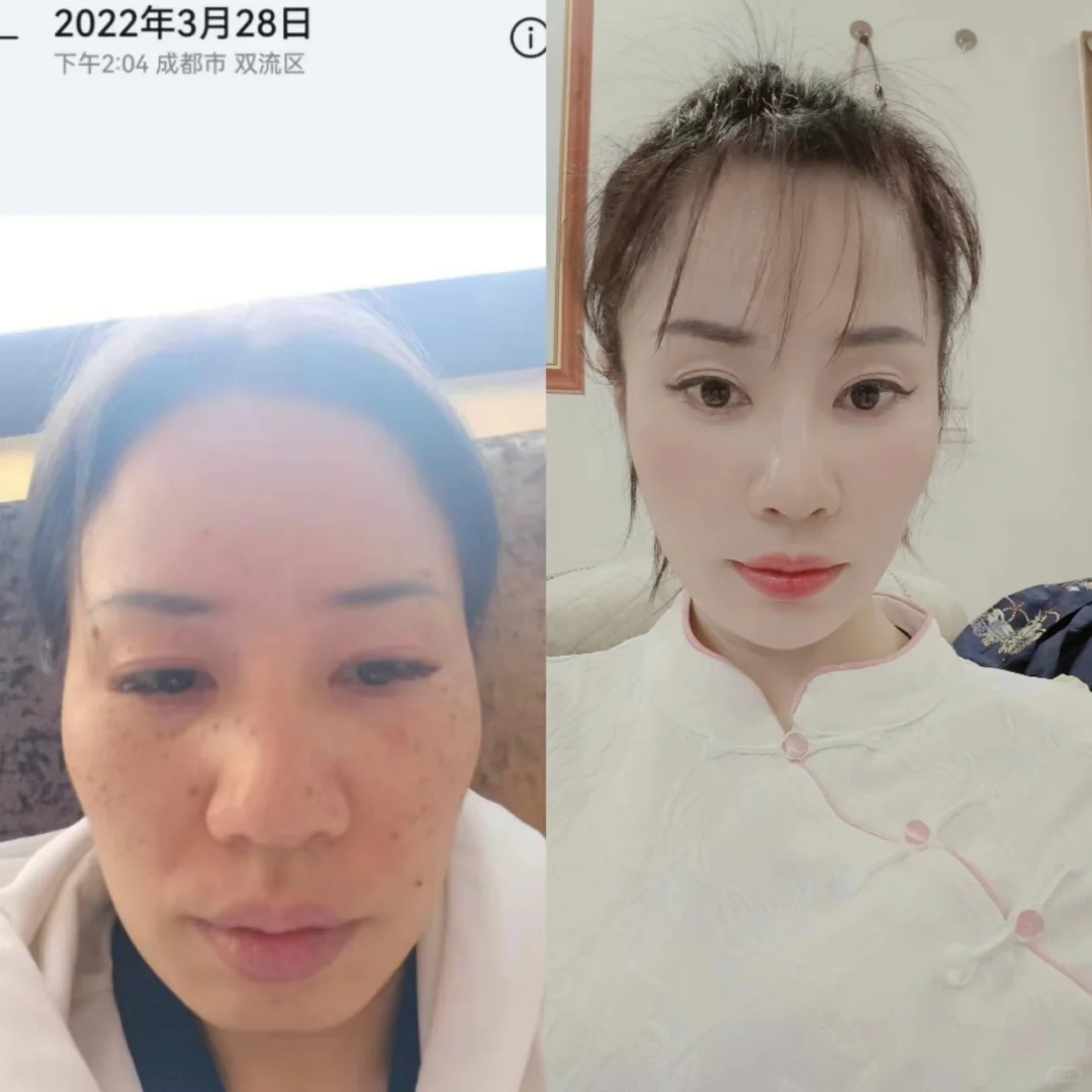 没整容半个月打造这个样子。