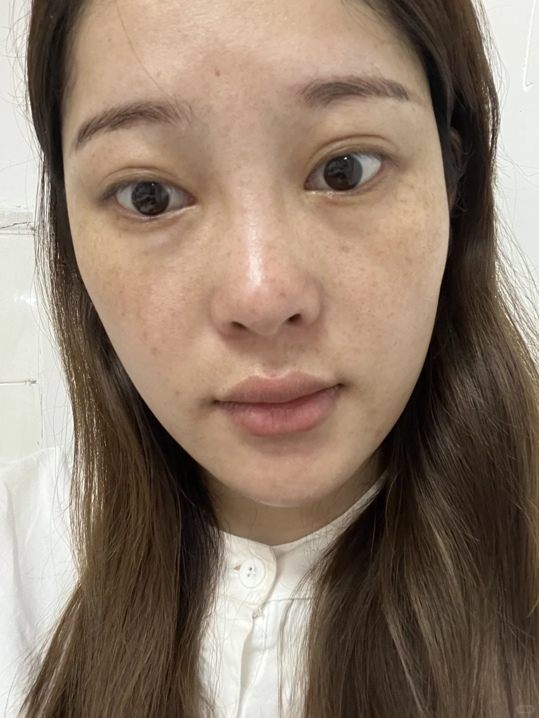 怎么与这一脸的斑和解