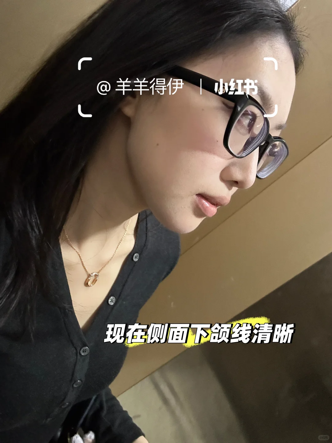 短下巴肉脸一年1w预算如何变美（思路大分享