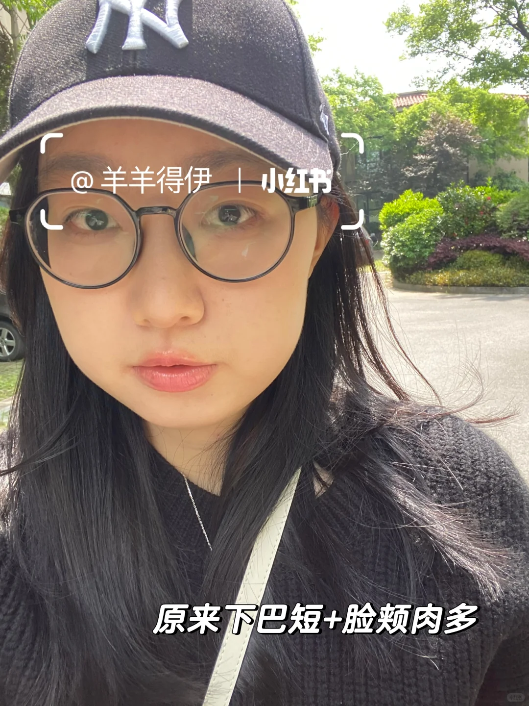 短下巴肉脸一年1w预算如何变美（思路大分享