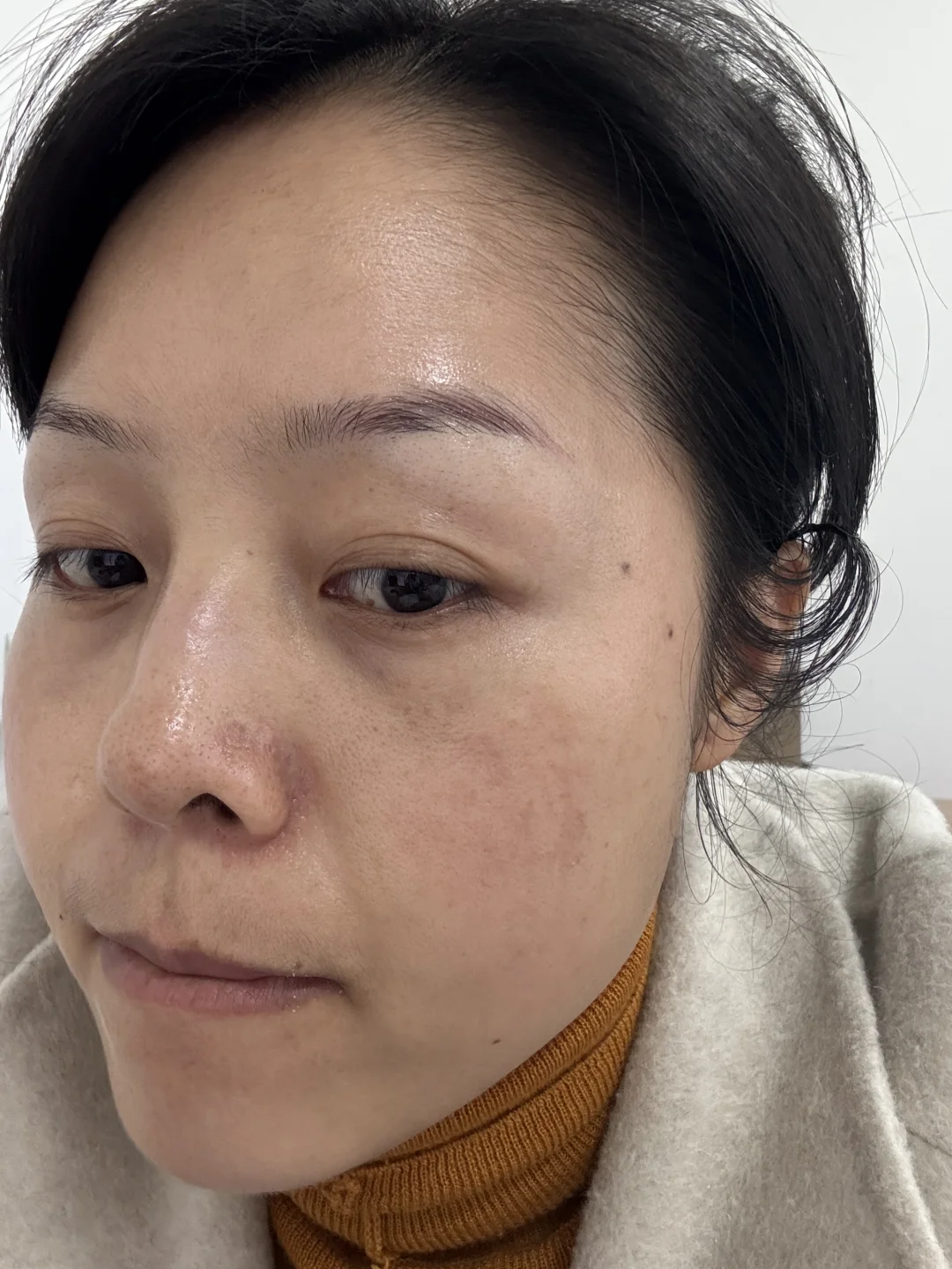 35岁，素颜，养肤一年多，真的可以改变面相！