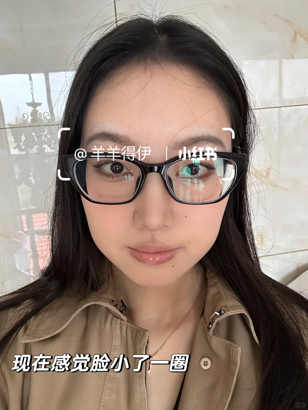 短下巴肉脸一年1w预算如何变美（思路大分享
