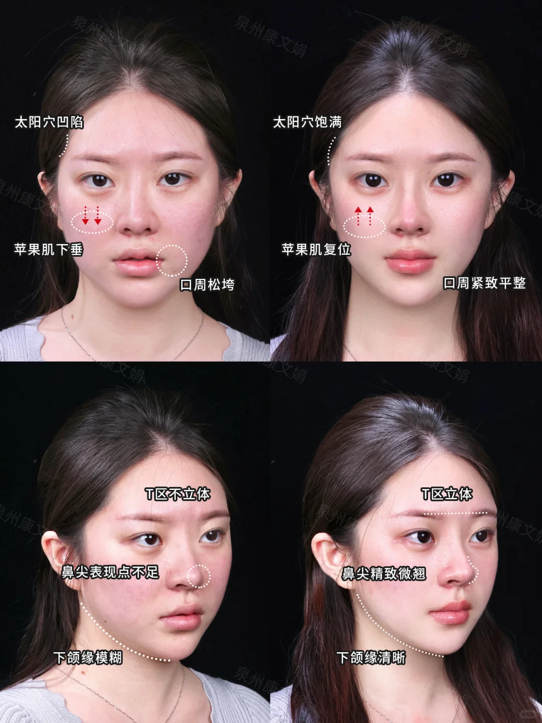 方圆脸天选微调圣体？直接变成幼态脸天花板