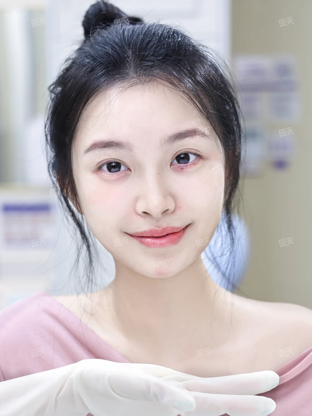 方圆脸毕业！自然妈生上镜也能赢