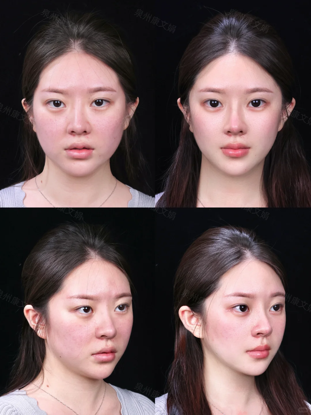 方圆脸天选微调圣体？直接变成幼态脸天花板