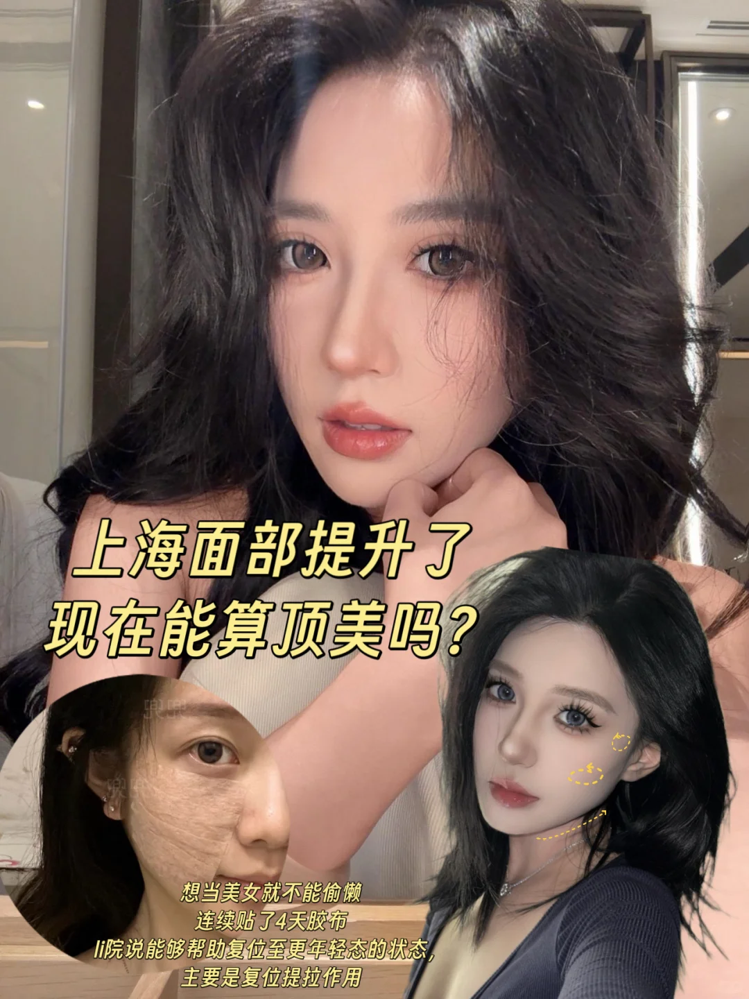上海面部提升｜爱美就会变美✨