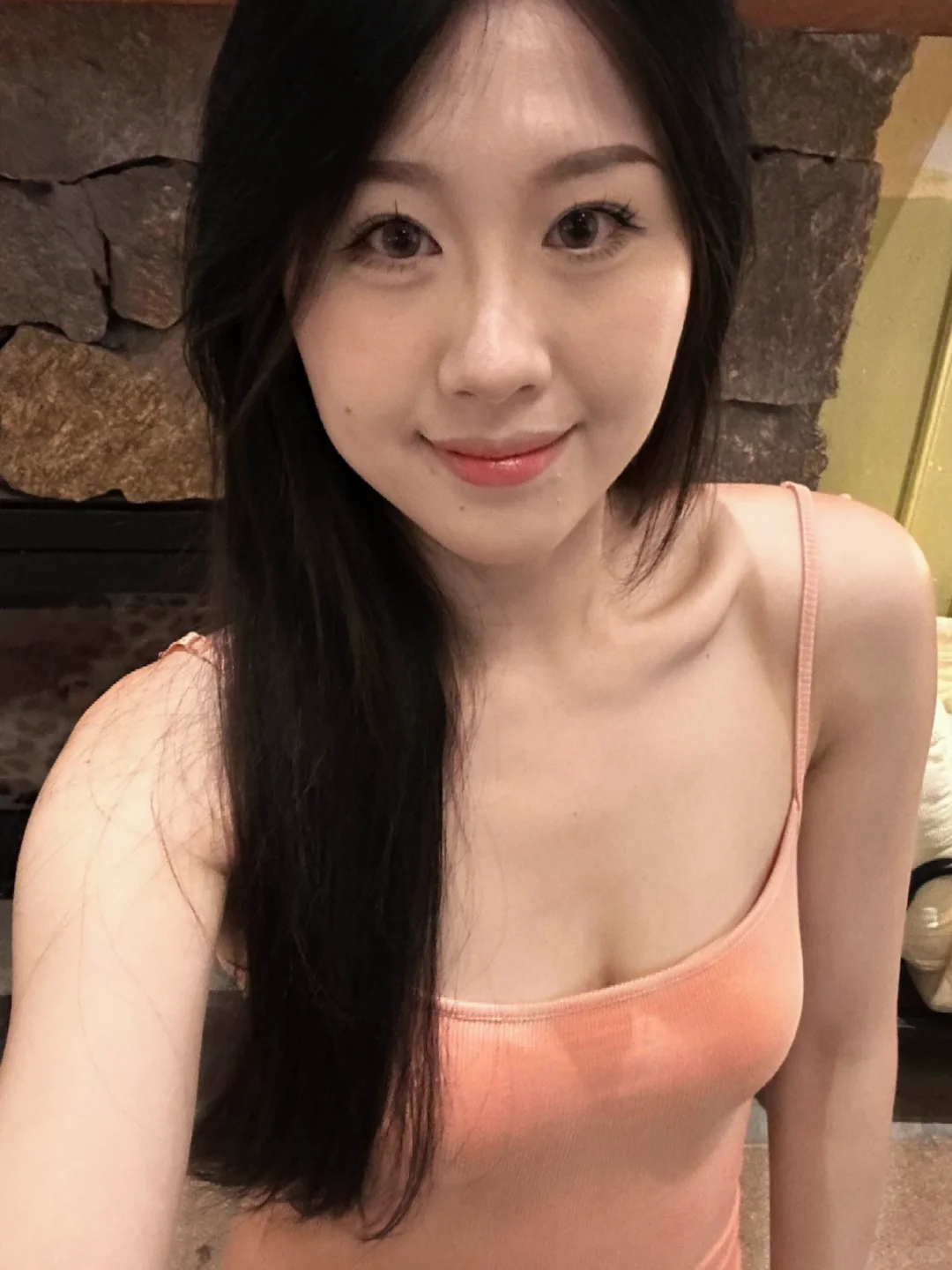 昆明改脸型，我喜欢自然美学派