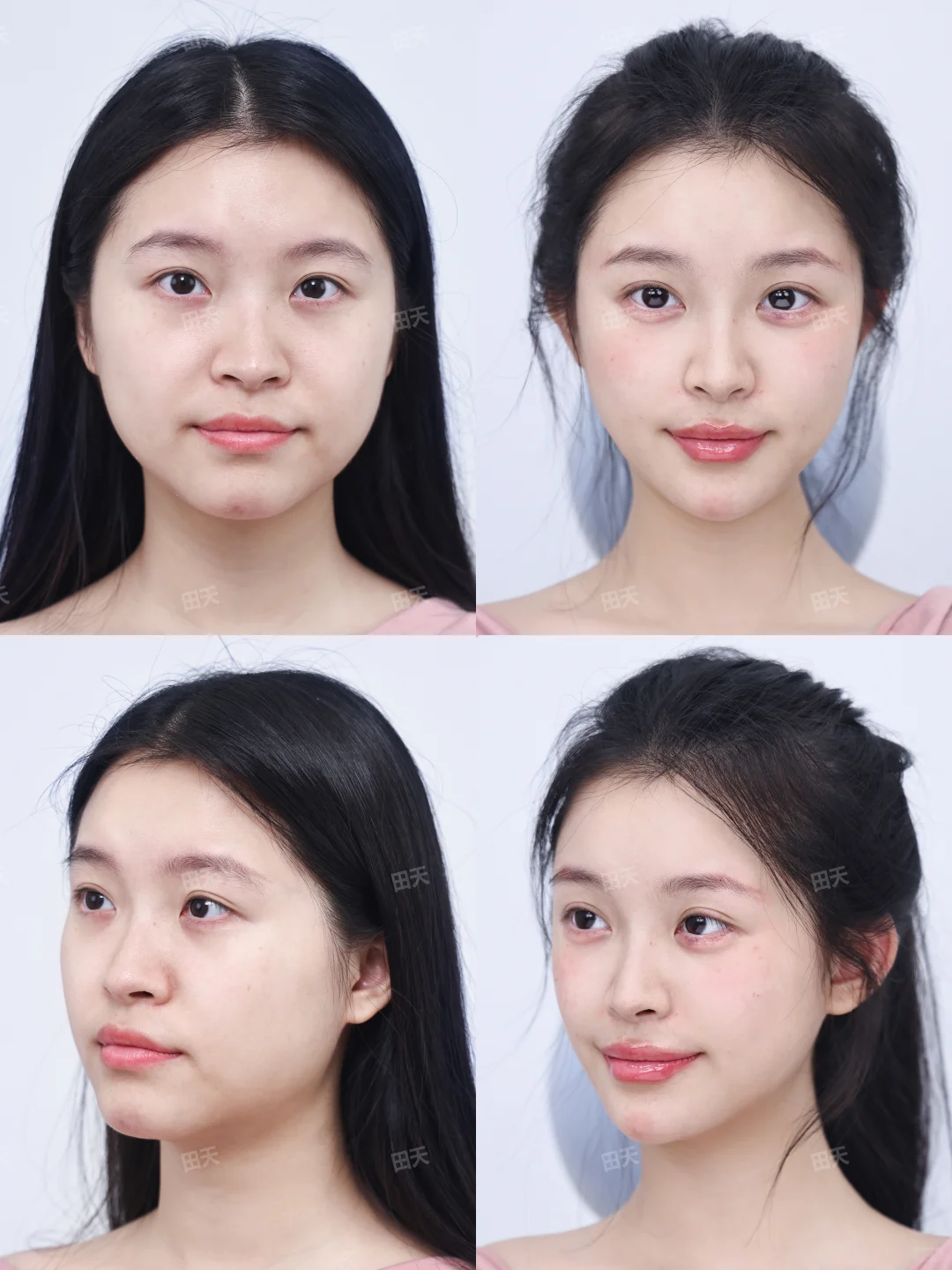 方圆脸毕业！自然妈生上镜也能赢