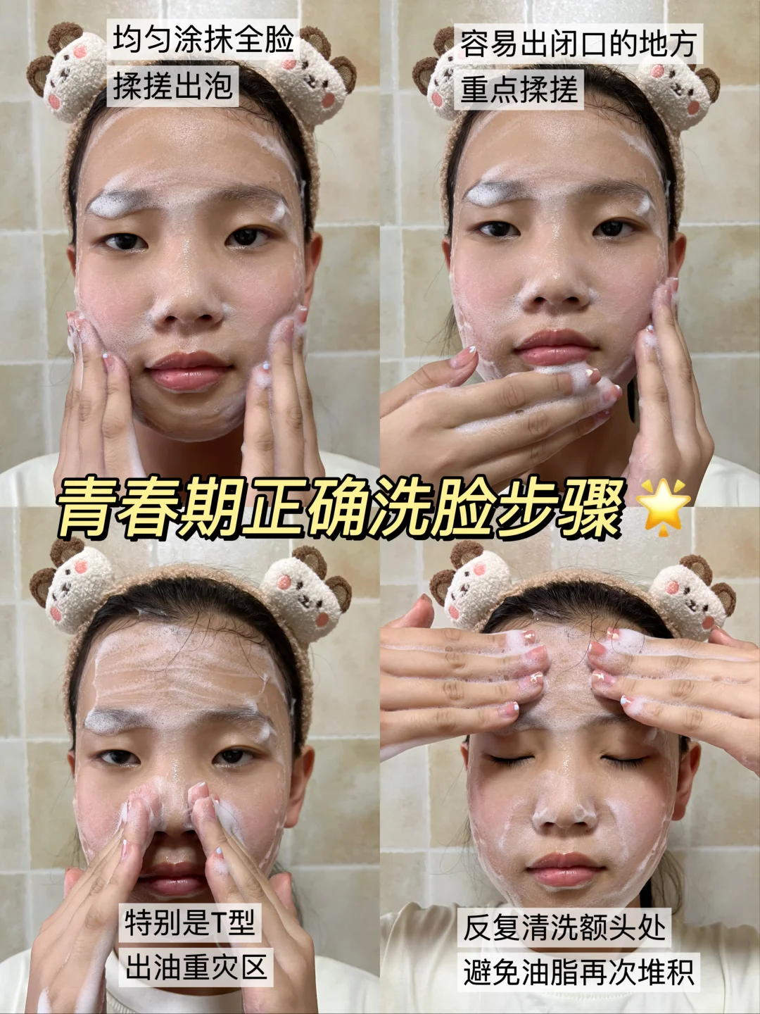 不花冤枉钱❗青春期油痘肌爆改妈生好皮